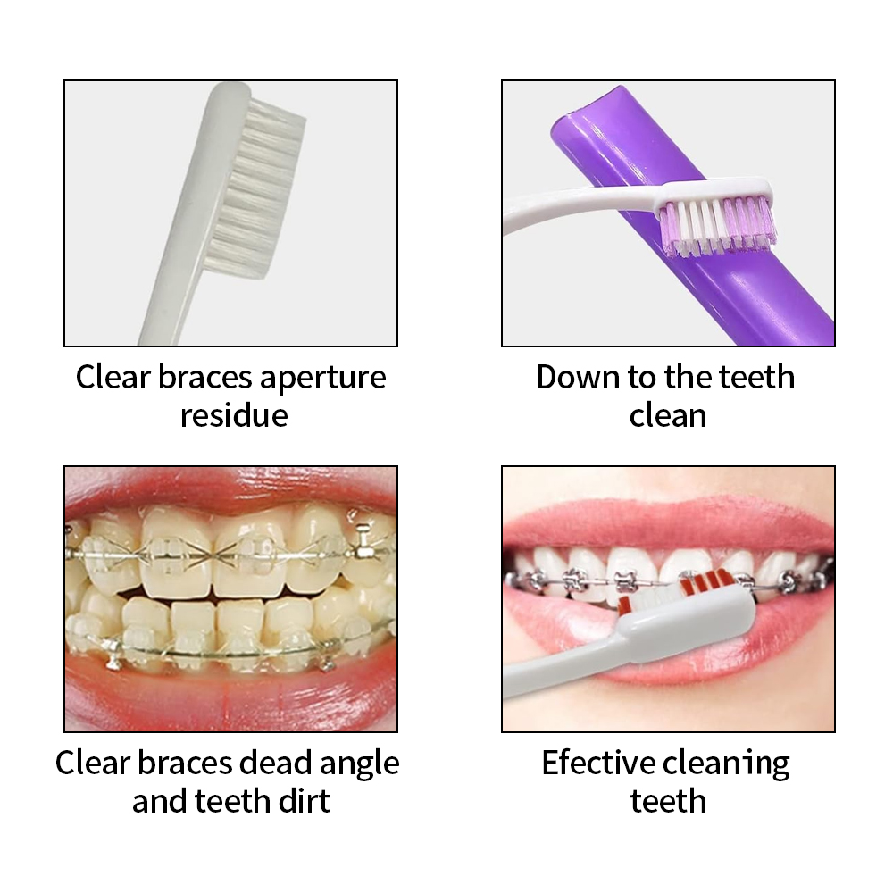 8Pcs/set Orthodontic Dental Ca - Waxing Kit Home review and price